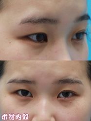 -上海漾颜医疗美容