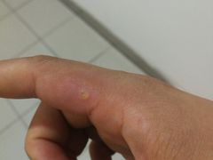 -无锡市第二人民医院(南院)