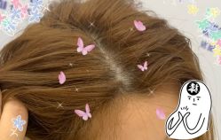 -大麦微针植发全国连锁