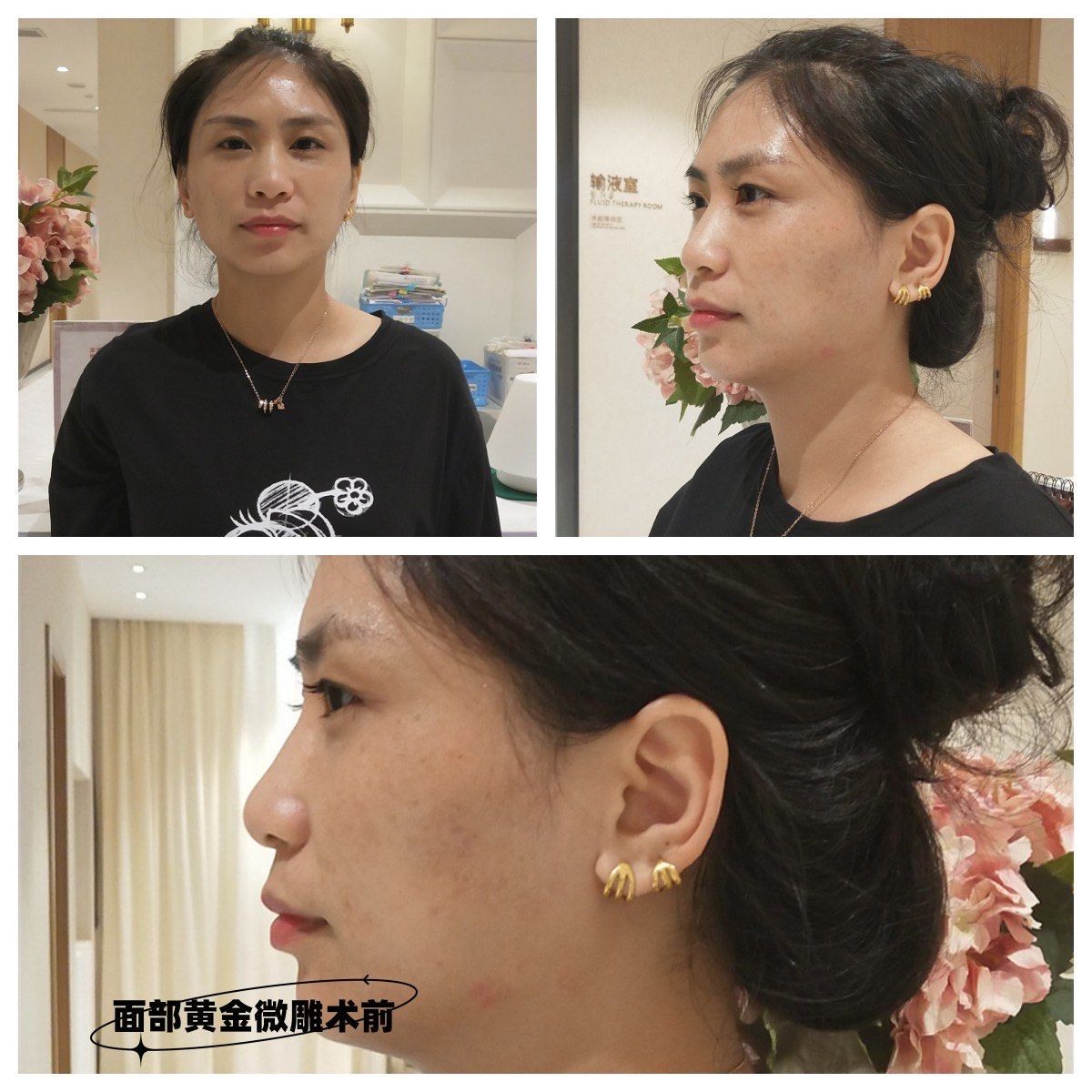 黄金微雕面部分享!