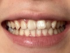 -宁波口腔医院(鄞州分院)