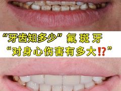 -团圆口腔·种植中心(锦江院区)