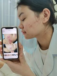 点击看大图 -凡碧诗毛孔清洁收细