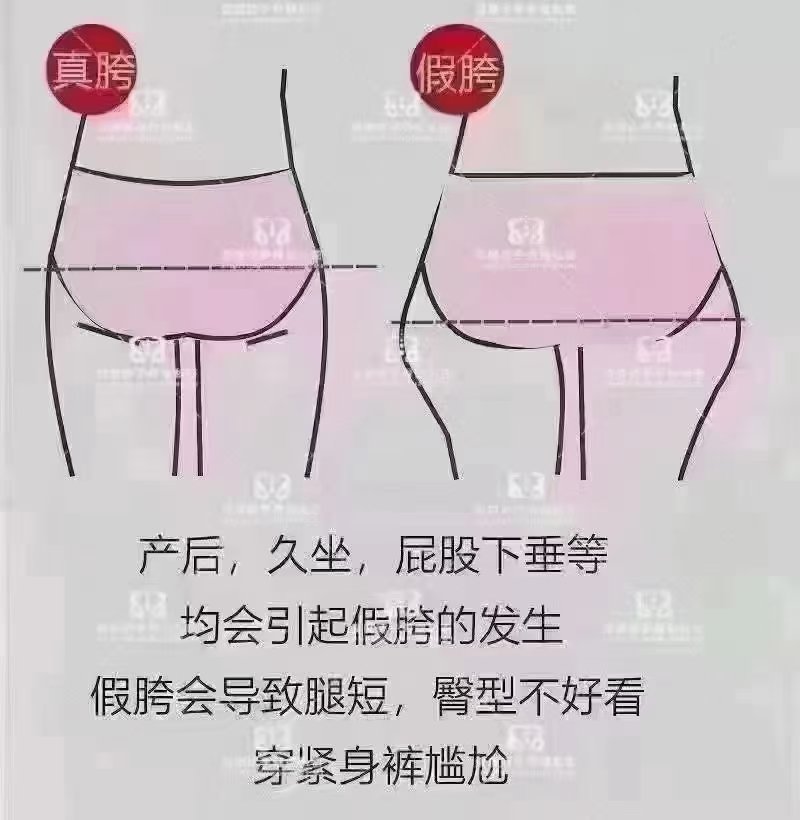 盆骨宽怎么变窄图片