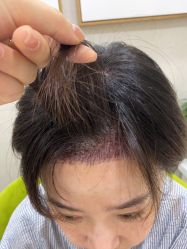 -熙朵美学植发·连锁品牌