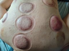 -艾通康缘艾灸.疼痛.睡眠养生馆(凤凰城店)