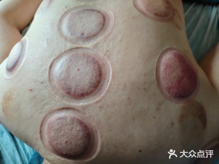 艾通康缘艾灸.疼痛.睡眠养生馆(凤凰城店)图片