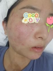 -深圳艺星医疗美容医院
