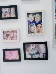 -蕾特恩专业祛痘国际连锁