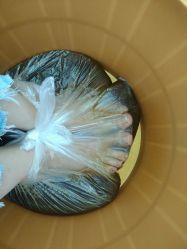 -派恩宜灰指甲鸡眼嵌甲手足癣