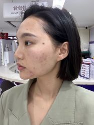 体验前-广州美莱医疗美容医院