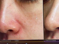 -苑苑vbeauty科技美容SPA