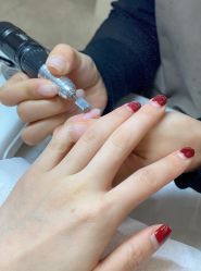 点击看大图 -U-Nail