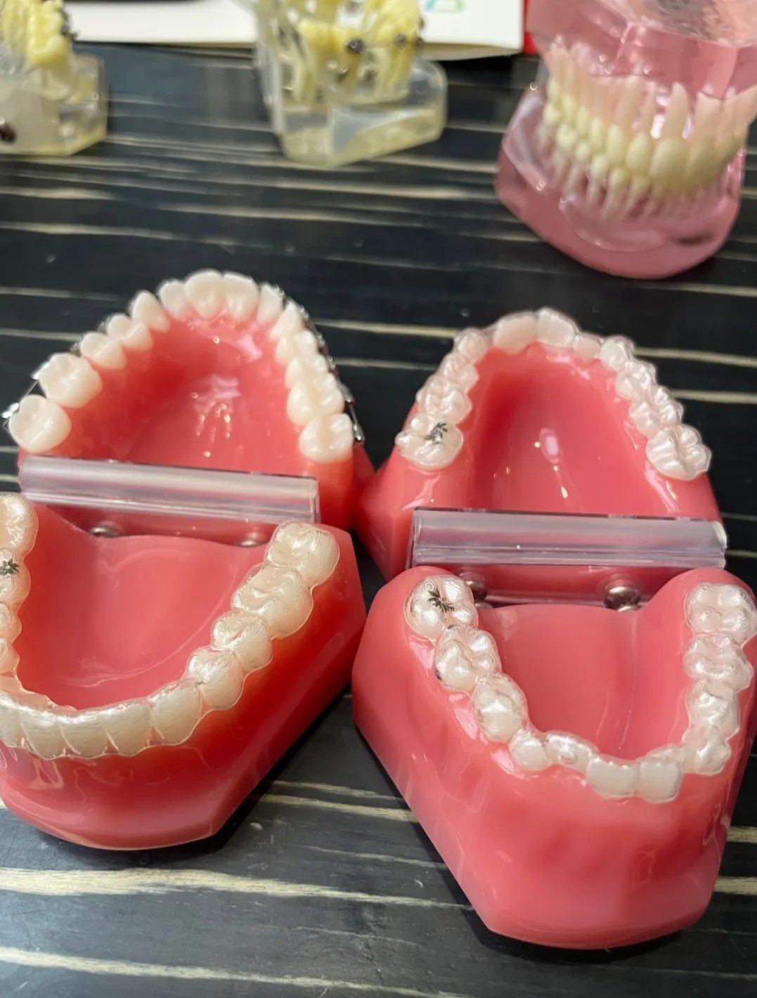 健康牙齿:全面治疗