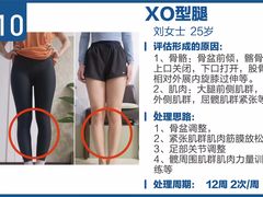 -体博士·疼痛调理·体态矫正·运动康复中心(大望路华贸店)