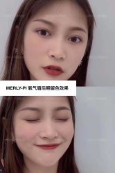 -MLP美丽派·问题肌疗愈中心