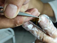 -新甲连锁灰指甲·甲沟炎·鸡眼(黑龙江路店)