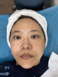 点击看大图 体验前-德媛医疗美容