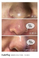 脸部抗衰-光SPA科技美肤