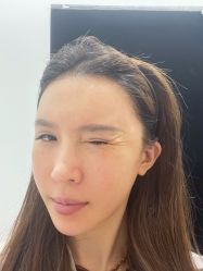 体验前-北京楚诺医疗美容
