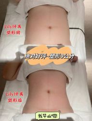 点击看大图 -Lily纤美·科技减脂中心