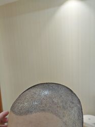 -碧莲盛·不剃发植发