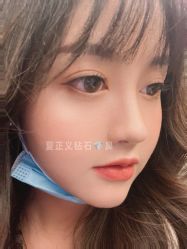 -北京米扬丽格医疗美容·联合丽格鼻整形中心