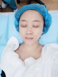 体验后-瑞鑫创美·高定轻医美
