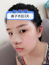 -素美医疗美容·西南眼鼻整形·修复基地