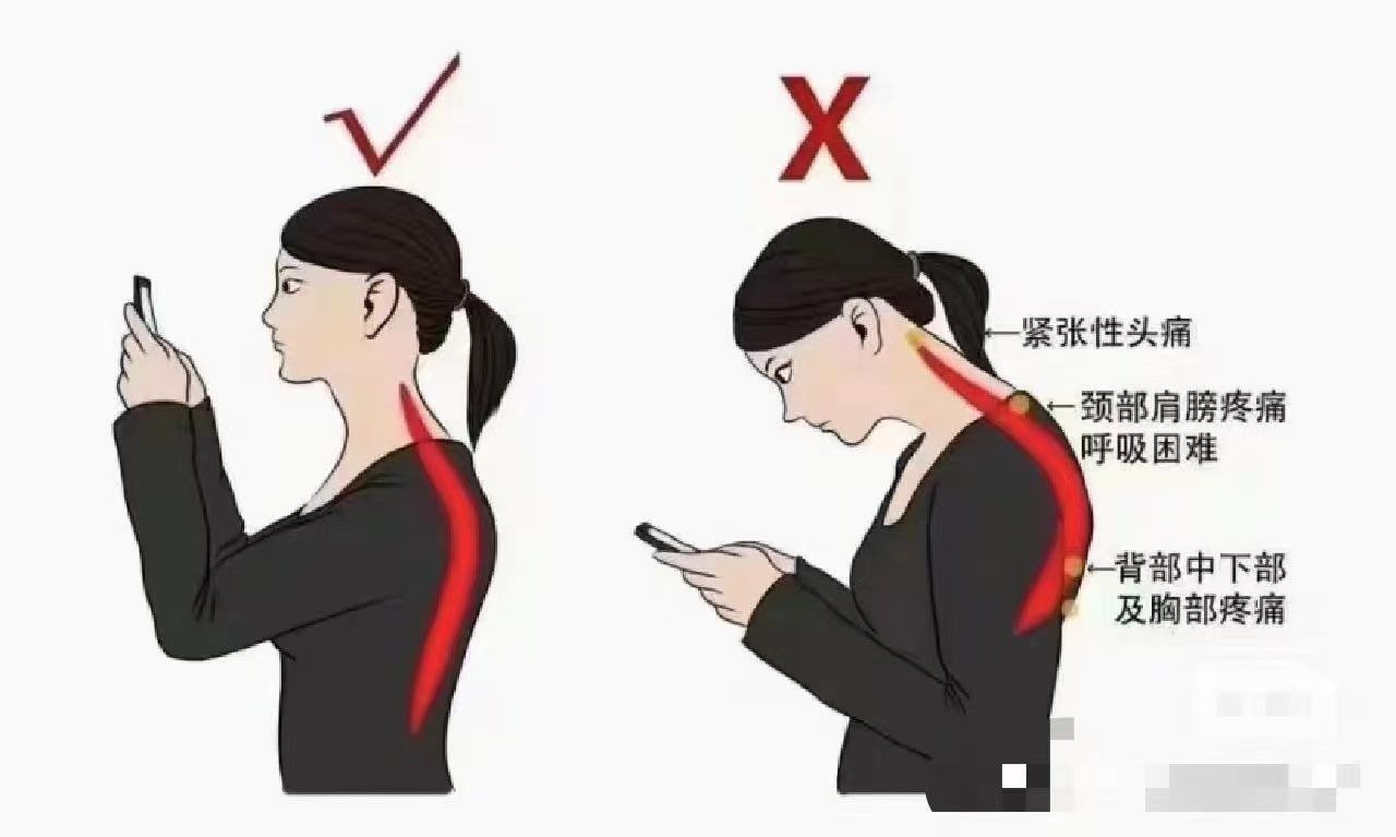 长期低头 长期低头,容易加强颈椎负担