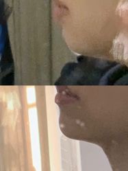 体验前-杭州星婉馨悦医疗美容