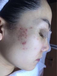-皇族养心堂·净痘·修敏·御颜