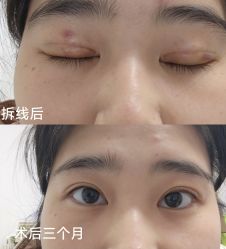 -JustHer宁波珈禾医疗美容医院