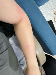 -北京美痣堂古方祛痣斑疣瘊