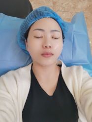 体验后-深圳阳光医疗美容