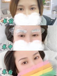 点击看大图 -Verywang半永久纹眉•仪器野生眉