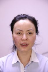 -北京叶子整形美容医院