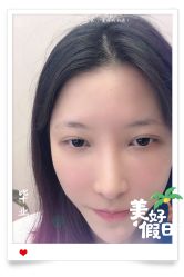 -大麦微针植发全国连锁