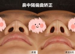 -北京米扬丽格医疗美容·联合丽格鼻整形中心