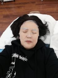 体验后-沈阳名流美容医院