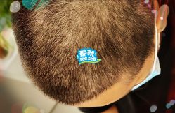 -大麦微针植发全国连锁