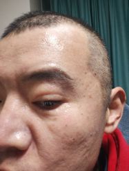 体验后-丽都整形美容医院·全国连锁旗舰店
