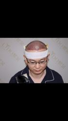 -熙朵美学植发连锁