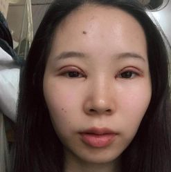 -西安壹加壹医疗美容医院