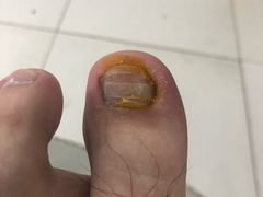 -新甲连锁灰指甲·甲沟炎·鸡眼(黑龙江路店)