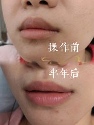 点击看大图 -西施无菌半永久纹绣眉眼影唇轻增发纹发际线