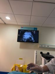 -杭州贝瑞斯美华妇儿医院·早孕·产检·儿科