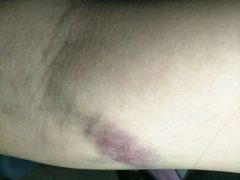 -北京中西医结合医院