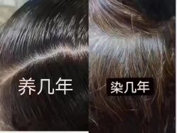 -顶尚堂白发脱发养发