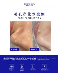 -靓芙泉专研痘痘肌